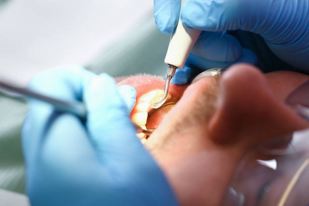 Best Urgent Dental Care for Toothaches in Rush City, MN