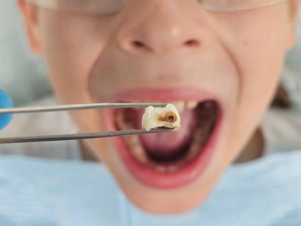 Best Emergency Pediatric Dental Care in Rush City, MN